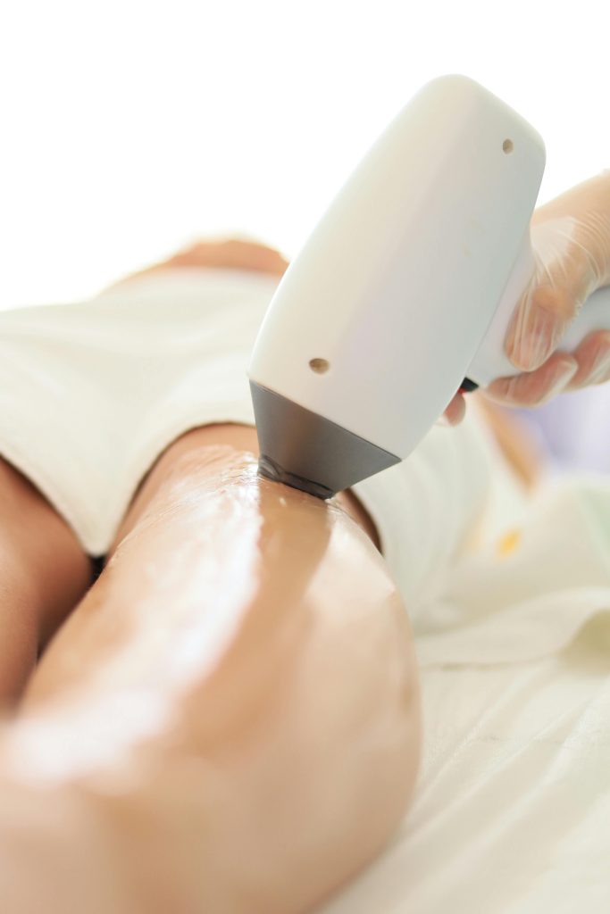 pexels-photo-16032305-16032305 Close-up of laser hair removal on woman's leg in professional spa setting.